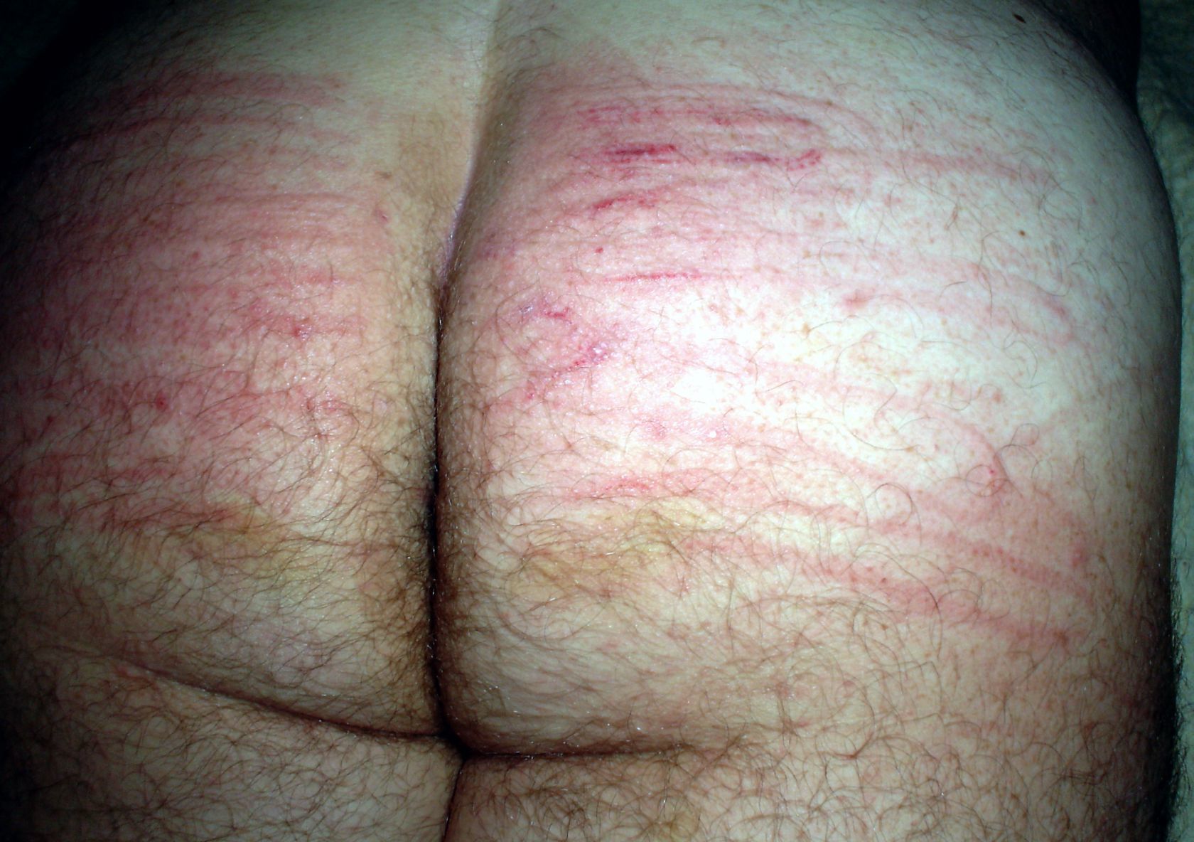 Hard spanking, for cucky, with electric cable. — 19